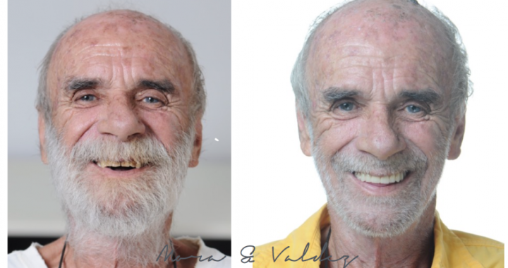Advanced dentistry before and after 1