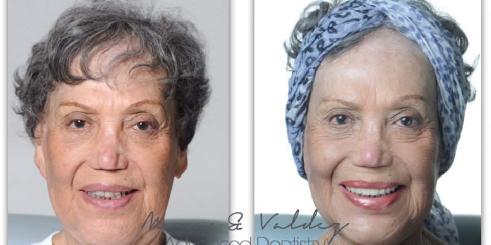 Advanced dentistry, antes y después