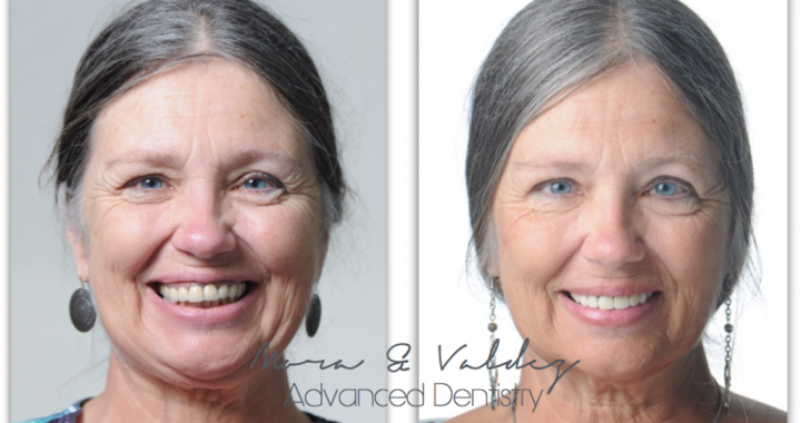 Advanced dentistry before and after 3